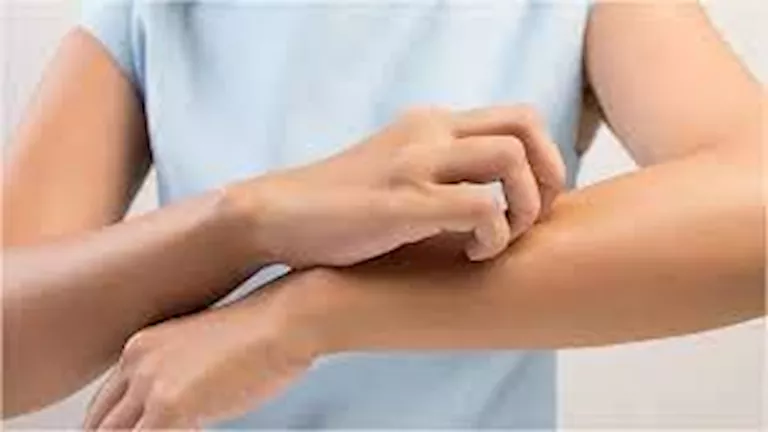 حكة مستمرة دون طفح جلدي.. أسباب خفية ومتى تستدعي زيارة الطبيب؟ -صدى الخبر حكة مستمرة دون طفح جلدي.. أسباب خفية ومتى تستدعي زيارة الطبيب؟ -صدى الخبر
