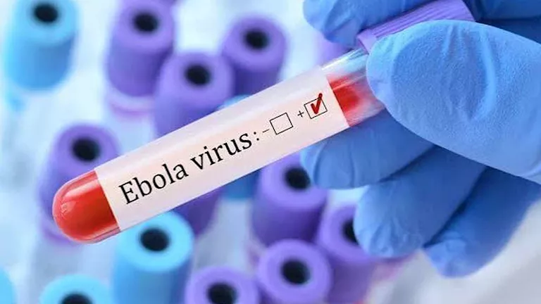 إصابات جديدة بفيروس إيبولا في كينيا إصابات جديدة بفيروس إيبولا في كينيا